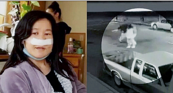 Japanese Teacher Seriously Injured in Seattle Attack - Vimarsana News